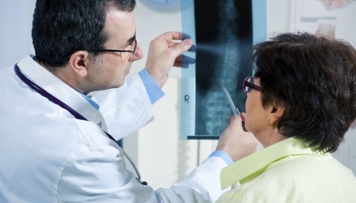 a gerinc röntgenfelvétele osteochondrosissal