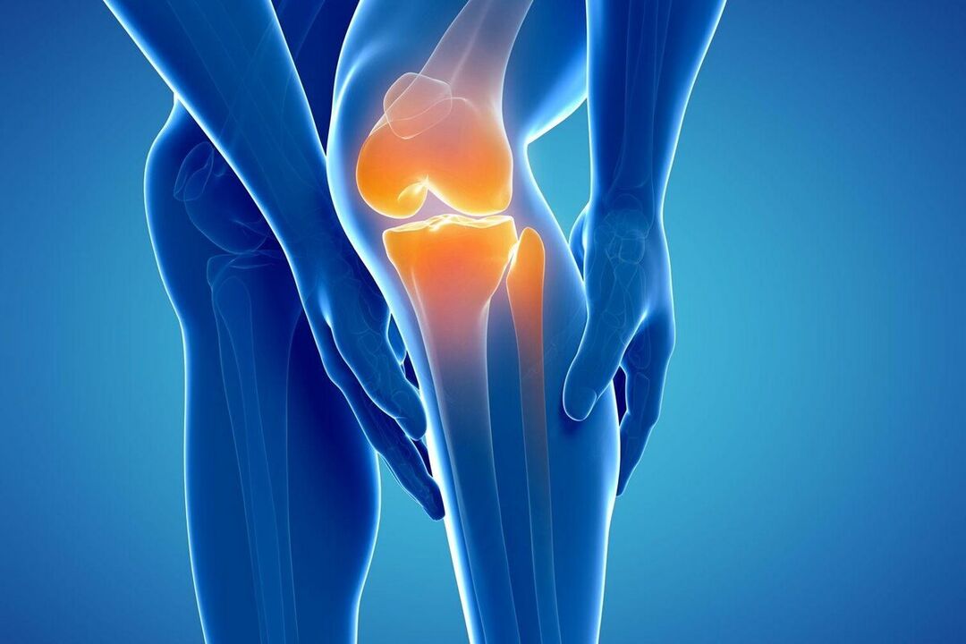 Mi az arthrosis
