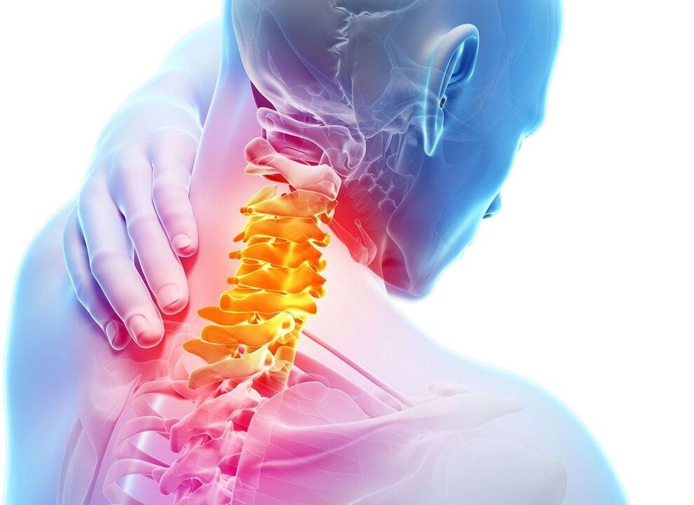 az osteochondrosis lokalizációja