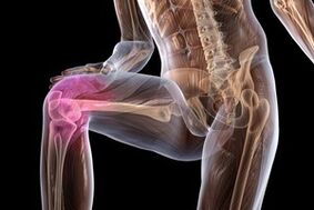 ízületi fájdalom térd arthrosis miatt